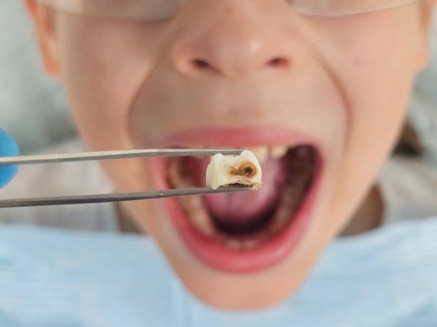 Best Emergency TMJ Treatment in Rustburg, VA
